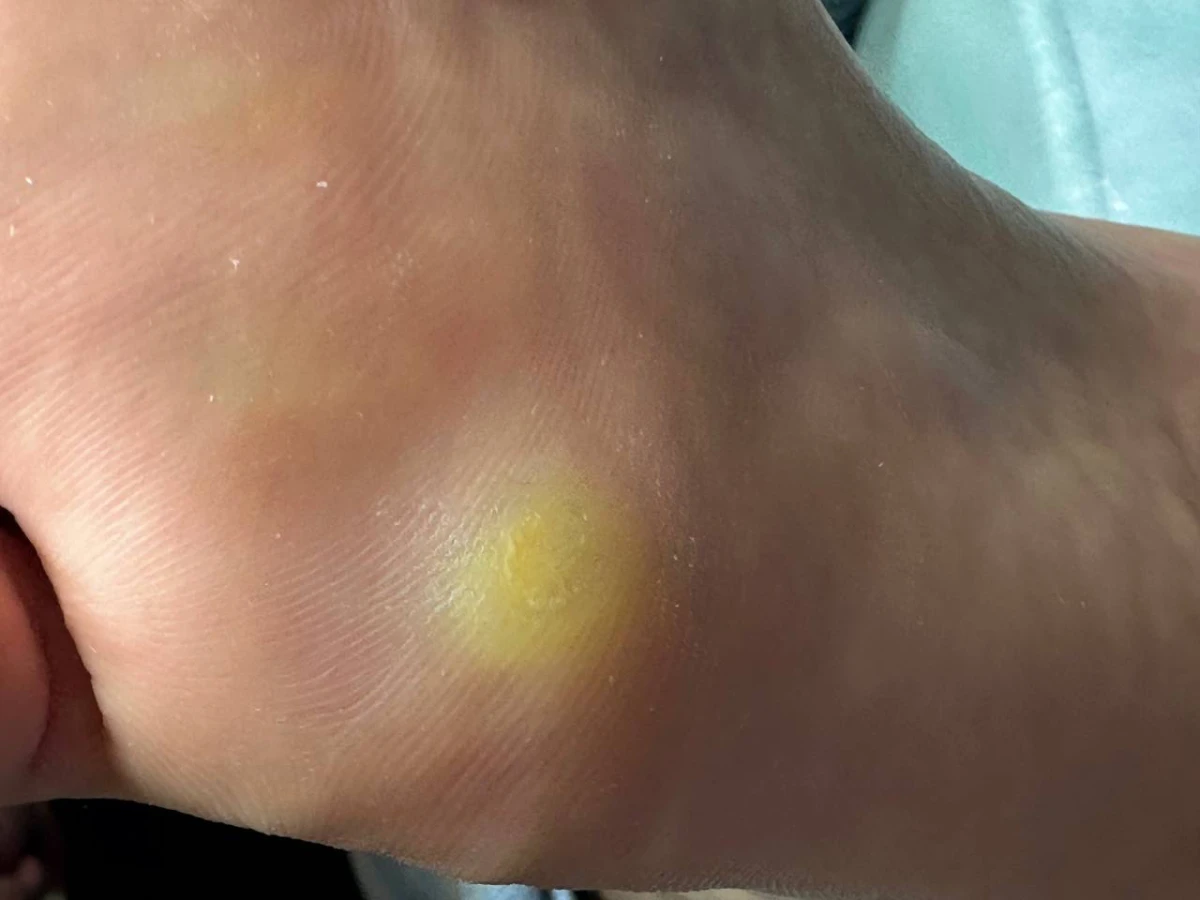 Medyczna Pielęgnacja Stóp